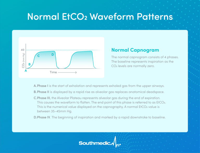 Capnography 101: A Comprehensive Guide to EtCO2 Monitoring for Patient ...